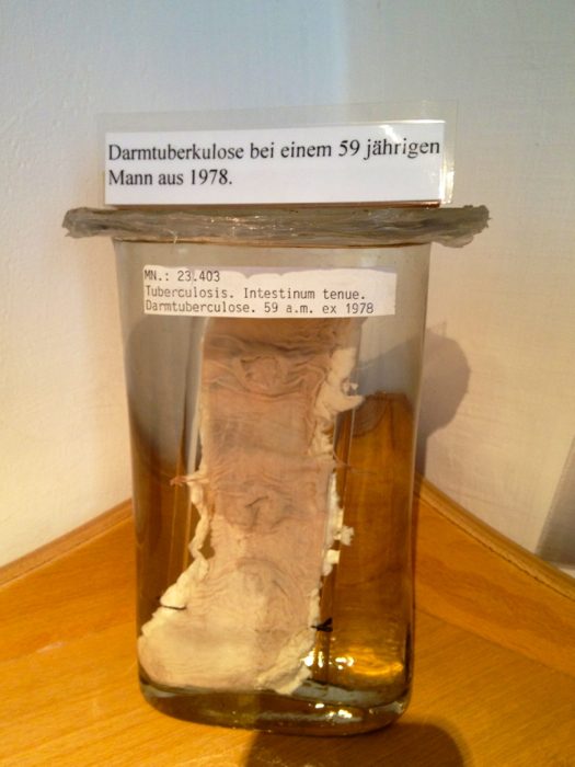 Narrenturm (Tower of Fools) (2).jpg
